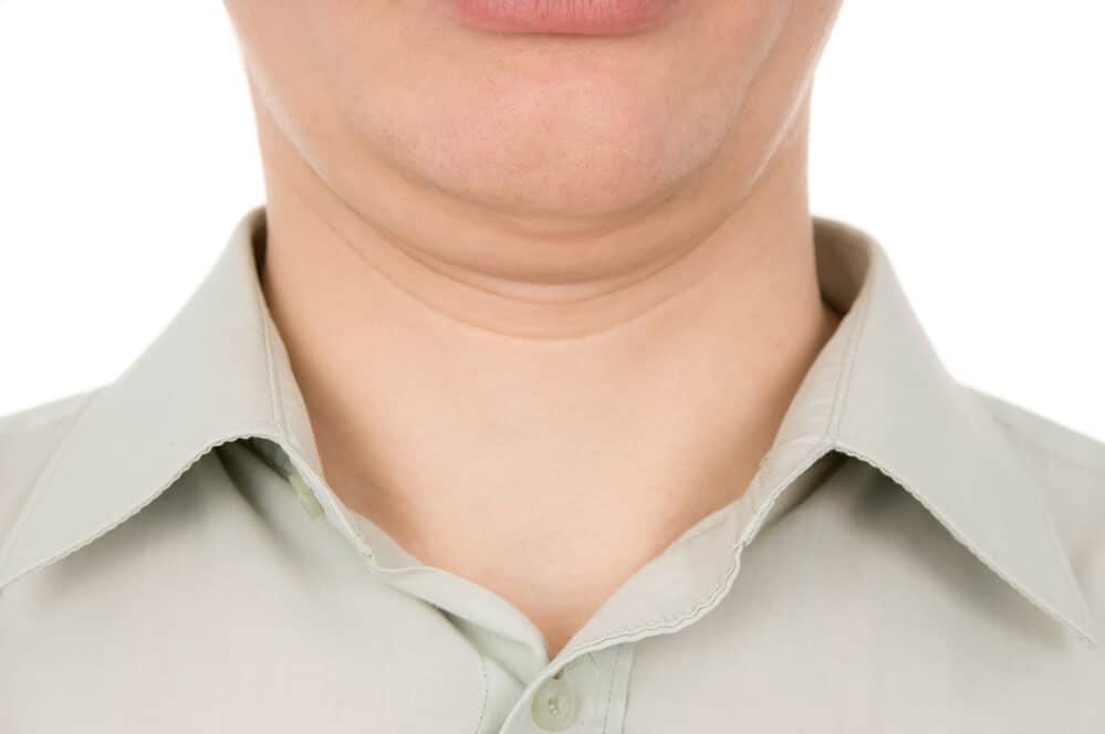 Do Beards Hide Double Chins?